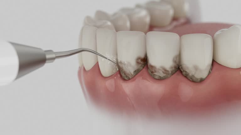 Reliable Dental Implants contractor in Pottsboro, TX by Smile Center Dentistry